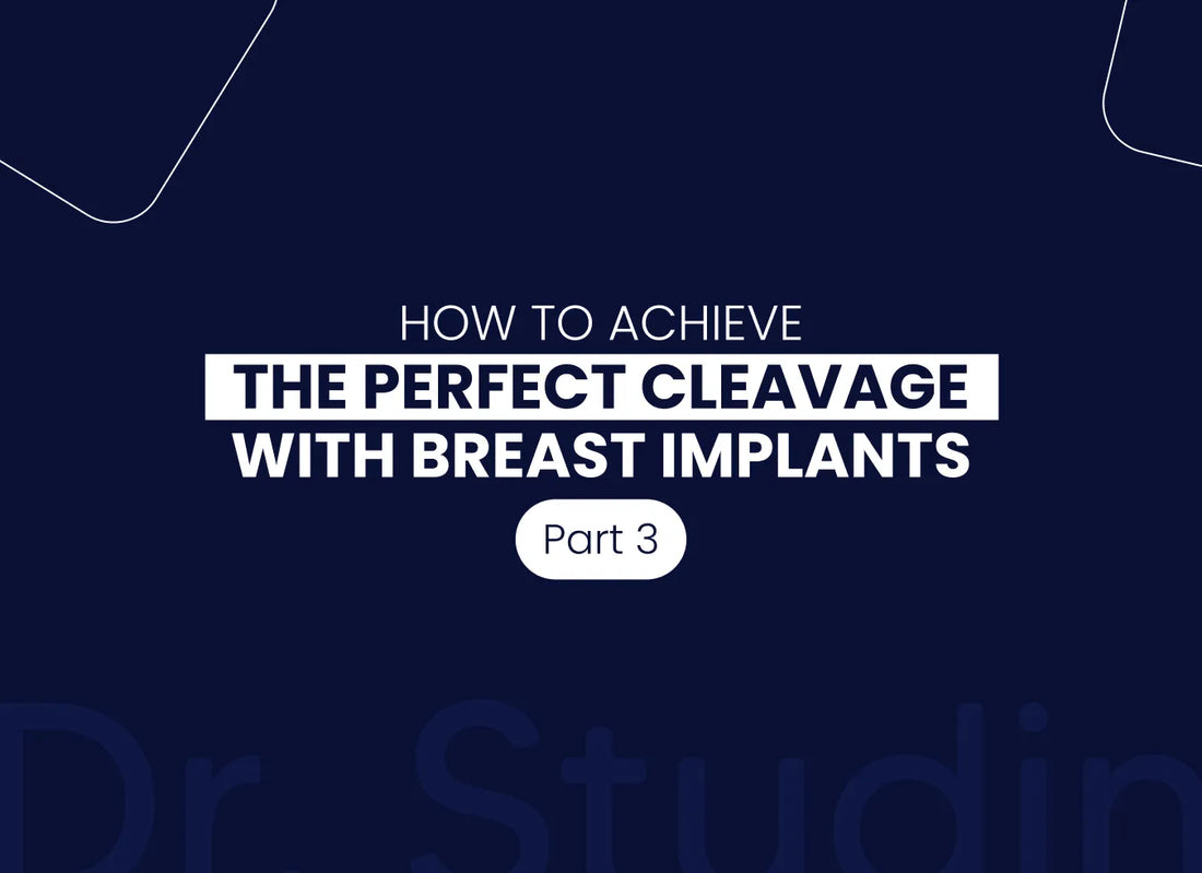 How Implant Profile Affects Cleavage and Lift