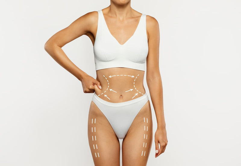 Liposuction + Tummy Tuck: The Ultimate Body Combo