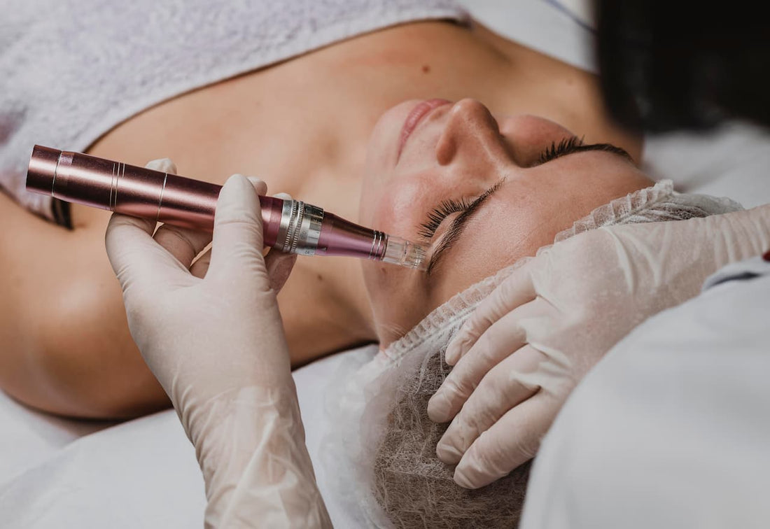 When Skin Renewal Becomes a Choice: PRP or Microneedling?