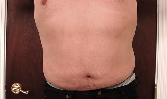 After Image 1