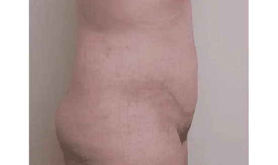 After Image 3