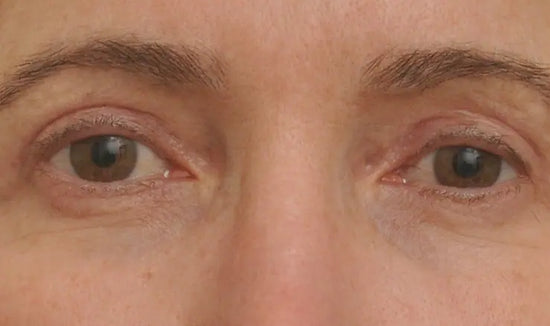 After Image 10