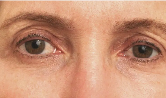 Before Image 10