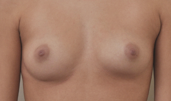 Before Image 6