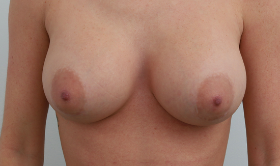 After Image 8