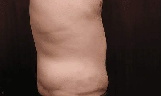 After Image 4