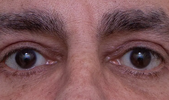After Image 3