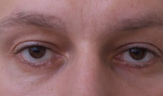 After Image 4