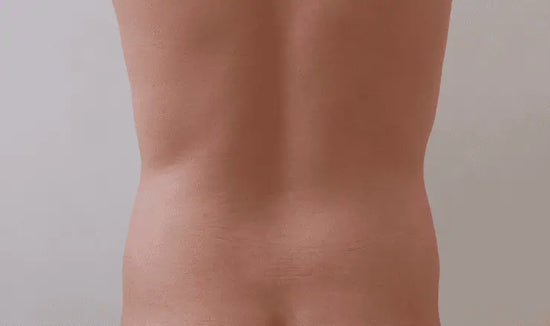 After Image 3