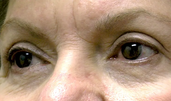 After Image 5