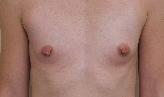 Before Image 1