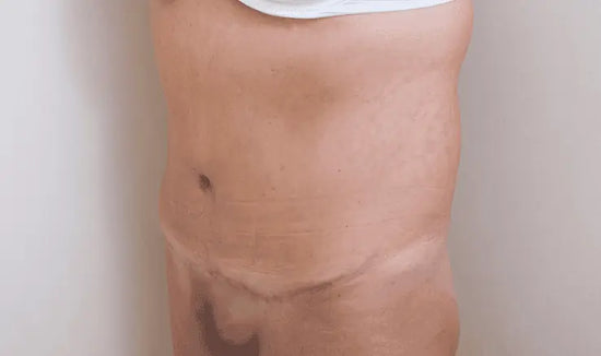 After Image 5