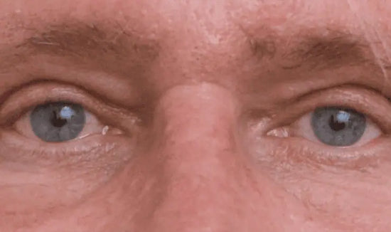 After Image 7