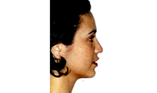 After Image 3