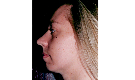Before Image 2