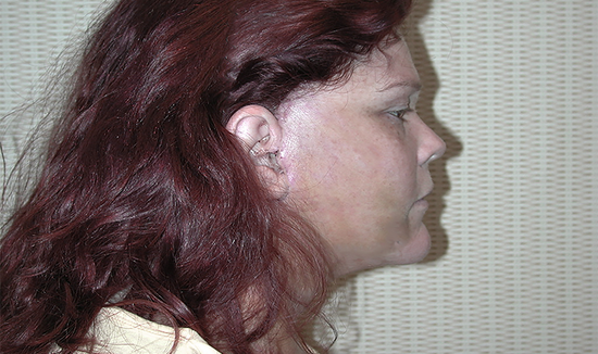 After Image 3