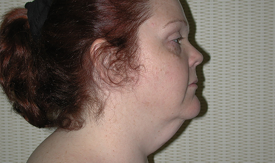 Before Image 3