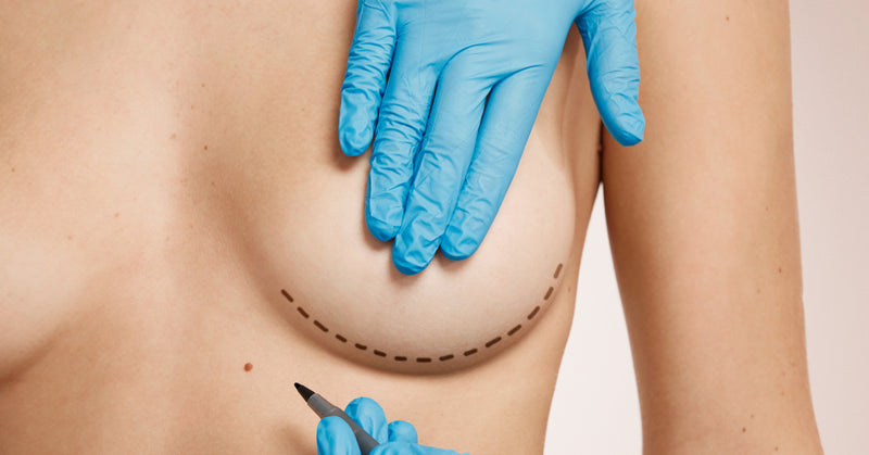 Choosing the Perfect Breast Implant Size: A Comprehensive Guide