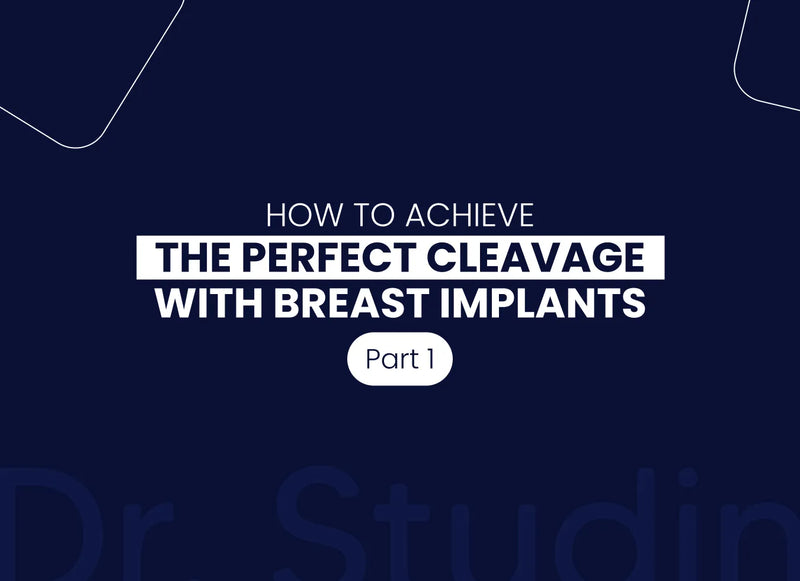 Achieving the Perfect Cleavage: Size and Placement Matter