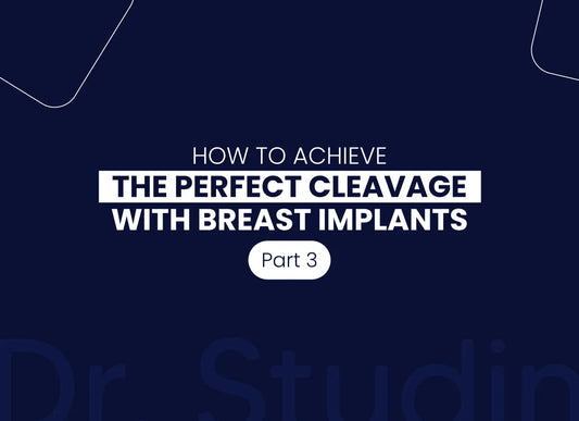 How Implant Profile Affects Cleavage and Lift