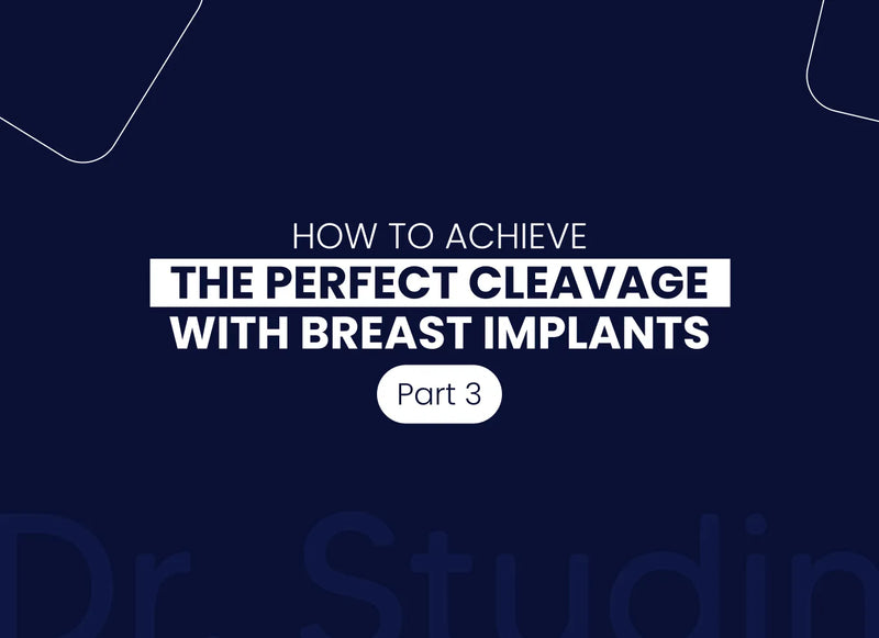 How Implant Profile Affects Cleavage and Lift