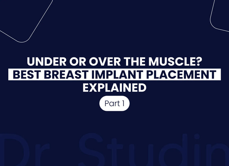 Choosing the Right Breast Implant Placement for Lasting Results