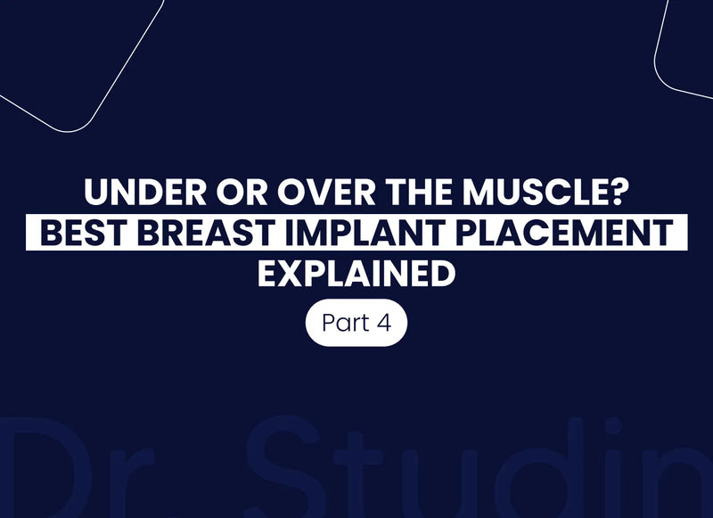 Choosing the Ideal Implant Placement for Your Body