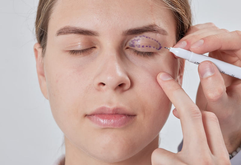 Eyelid Surgery: Brightening Your Look with Subtle Precision