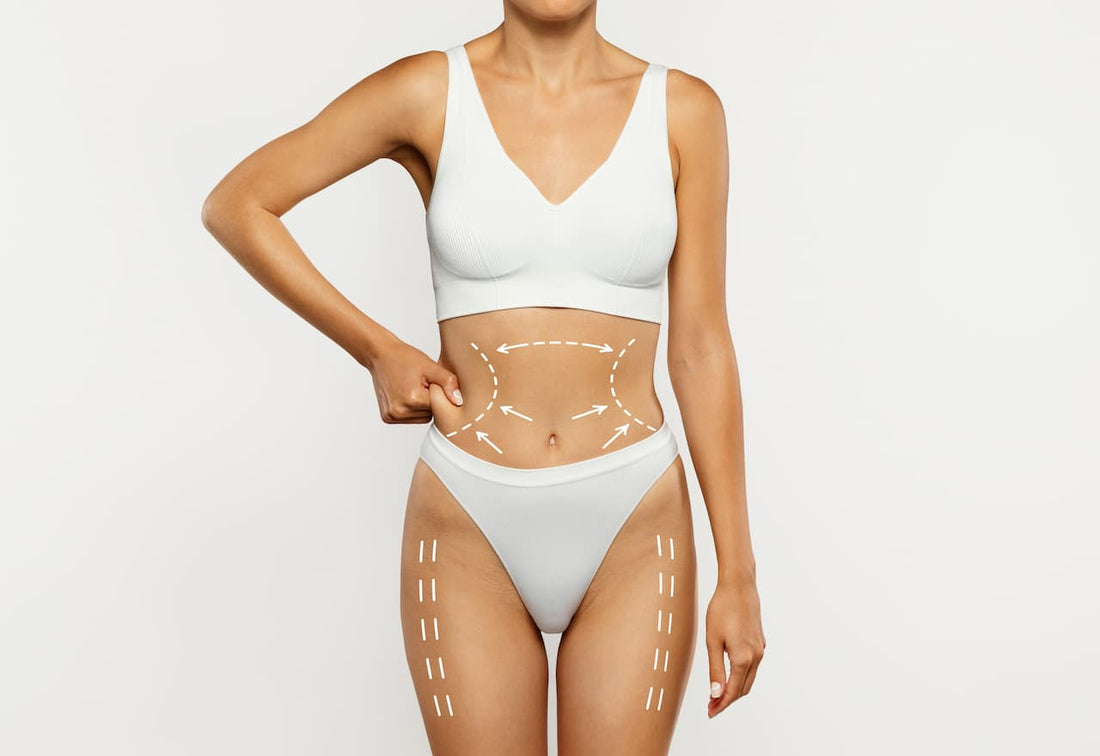 Liposuction + Tummy Tuck: The Ultimate Body Combo