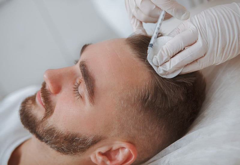 The Rise of PRP Hair Restoration for Men in NYC