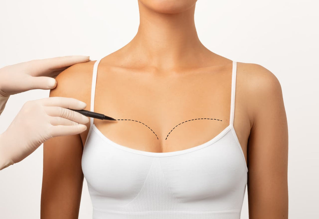 Under or Over the Muscle? Here's What You Need to Know About Breast Implant Placement