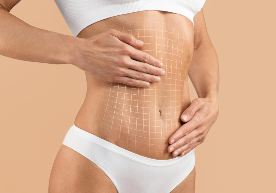 tummy-tuck-cropped-female-body-with-flat-abdomen-drawn-mesh